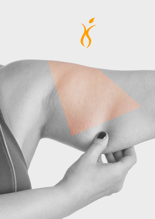 LIPOSUCTION (Liposakşın), YAĞ ALMA
