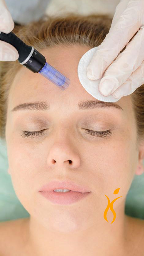 Dermapen
